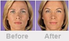 Dermatologist Jupiter