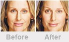 Dermatologist Jupiter