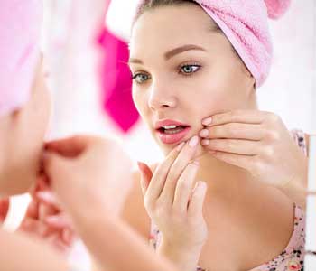 Inflamed skin of Acen Treatment from Jupiter, FL dermatologist