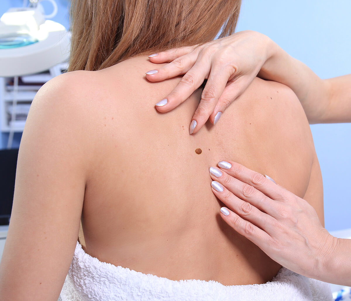 Early Detection and Treatment for Skin Cancer in Jupiter Area