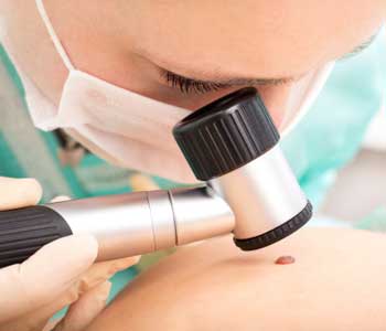 Skin Cancer Free Life